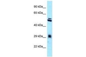 Image no. 1 for anti-Thioredoxin-Related Transmembrane Protein 1 (TMX1) (C-Term) antibody (ABIN6747965) (TMX1 抗体  (C-Term))