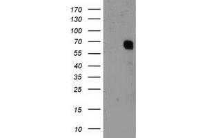 HEK293T cells were transfected with the pCMV6-ENTRY control (Left lane) or pCMV6-ENTRY GTF2F1 (Right lane) cDNA for 48 hrs and lysed. (GTF2F1 抗体)