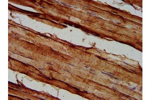 Immunohistochemistry (IHC) image for anti-Sema Domain, Immunoglobulin Domain (Ig), Short Basic Domain, Secreted, (Semaphorin) 3C (SEMA3C) (AA 292-396) antibody (ABIN7168789)