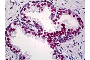 Anti-TRIM28 antibody IHC of human prostate. (KAP1 抗体  (AA 379-524))