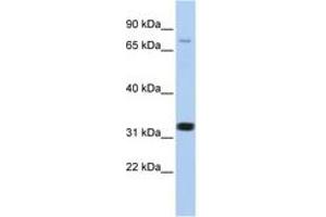Image no. 1 for anti-Calcium Channel, Voltage-Dependent, beta 2 Subunit (CACNB2) (AA 21-70) antibody (ABIN6742718)