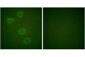 Immunofluorescence analysis of HuvEc cells, using Tyrosine Hydroxylase (Phospho-Ser19) Antibody. (Tyrosine Hydroxylase 抗体  (pSer18))