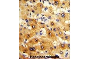 Immunohistochemistry (IHC) image for anti-Ribosomal Protein S15 (RPS15) antibody (ABIN3002876) (RPS15 抗体)