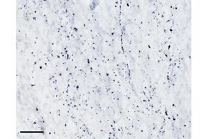 (ABIN768607) (scale bar: 50 μm) immunostaining of TPH2 processes in cryosection of the infundibular nucleus of an immersion-fixed (4 % PFA) human hypothalamus. (Tryptophan Hydroxylase 2 抗体  (AA 16-29))