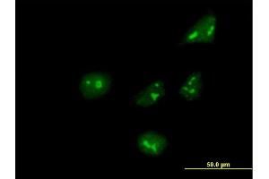 Immunofluorescence of purified MaxPab antibody to ARHGEF10 on HeLa cell. (ARHGEF10 抗体  (AA 1-380))