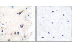 Immunohistochemistry analysis of paraffin-embedded human brain tissue, using PLCB3 (Ab-1105) Antibody. (PLCB3 抗体  (AA 1071-1120))