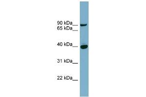 WB Suggested Anti-PNPLA8 Antibody Titration: 0. (PNPLA8 抗体  (Middle Region))