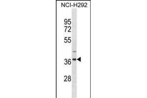 ZN Antibody (N-term) (ABIN1882033 and ABIN2838649) western blot analysis in NCI- cell line lysates (35 μg/lane). (ZNF696 抗体  (N-Term))