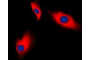 Immunofluorescent analysis of Alpha-actin-3 staining in HeLa cells. (ACTG2 抗体  (N-Term))