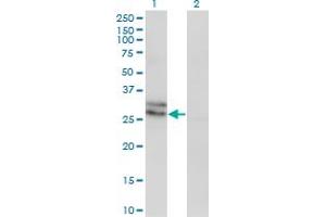 Western Blot analysis of EDN3 expression in transfected 293T cell line by EDN3 monoclonal antibody (M01), clone 2A6-2A4. (Endothelin 3 抗体  (AA 1-238))