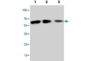 Western blot analysis of rbinate mouse Cx3cl1 protein with Cx3cl1 polyclonal antibody . (CX3CL1 抗体  (N-Term))