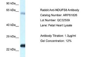 Western Blotting (WB) image for anti-NADH Dehydrogenase (Ubiquinone) Fe-S Protein 8, 23kDa (NADH-Coenzyme Q Reductase) (NDUFS8) (C-Term) antibody (ABIN2788918) (NDUFS8 抗体  (C-Term))