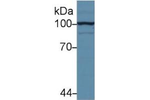Rabbit Capture antibody from the kit in WB with Positive Control: Sample Human hela cell lysate. (Hexokinase 2 ELISA 试剂盒)