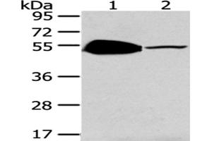 Western Blotting (WB) image for anti-TSPY-Like 1 (TSPYL1) antibody (ABIN5962132) (TSPYL1 抗体)