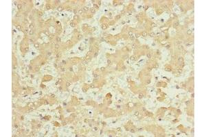 Immunohistochemistry of paraffin-embedded human liver tissue using ABIN7157665 at dilution of 1:100 (NUF2 抗体  (AA 165-464))