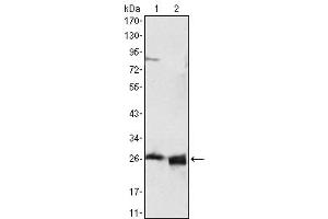 Western Blot showing using APOA1 antibody used against HepG2 cell lysate (1) and human serum (2). (APOA1 抗体)