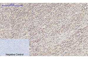 Immunohistochemical analysis of paraffin-embedded human uterus tissue.