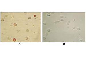 Immunocytochemistry analysis of TPA induced BCBL-1 cells (A) and uninduced BCBL-1 cells (B) using KSHV ORF45 mouse mAb with AEC staining. (KSHVORF45 抗体)