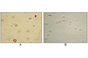 Immunocytochemistry analysis of TPA induced BCBL-1 cells (A) and uninduced BCBL-1 cells (B) using KSHV ORF45 mouse mAb with AEC staining.