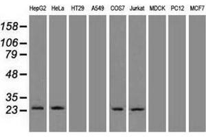 Western blot analysis of 35 µg of cell extracts from human brain tissue lysates using anti-NEUROG1 antibody. (Neurogenin 1 抗体)