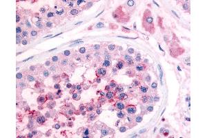 Anti-PDE3A antibody IHC of human testis. (PDE3A 抗体  (N-Term))