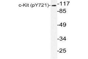 Western blot (WB) analyzes of p-c-Kit (pTyr721) antibody in extracts from HepG2 EGF cells. (KIT 抗体  (pTyr721))