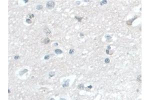 Immunohistochemistry (IHC) image for anti-Barrier To Autointegration Factor 1 (BANF1) (AA 2-89) antibody (ABIN7444295)
