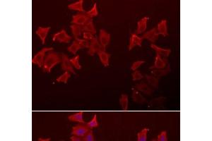 Immunofluorescence analysis of A549 cells using LECT1 Polyclonal Antibody (LECT1 抗体)