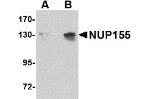 Western Blotting (WB) image for anti-Nucleoporin 155kDa (NUP155) (C-Term) antibody (ABIN1030553) (NUP155 抗体  (C-Term))