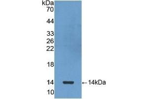 Detection of Recombinant bTG, Human using Polyclonal Antibody to Chemokine (C-X-C motif) ligand 7 ( CXCL7) (CXCL7 抗体  (AA 59-128))