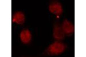 ABIN6274194 staining 293 cells by IF/ICC. (TBP 抗体  (N-Term))