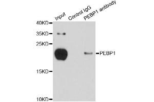 Immunoprecipitation analysis of 150ug extracts of MCF-7 cells using 3ug PEBP1 antibody. (PEBP1 抗体)