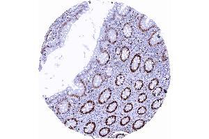 MCM2 staining is strongest in epithelial cells of colonic crypts. (Recombinant MCM2 抗体)