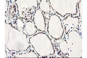 Image no. 3 for anti-Latexin (LXN) antibody (ABIN1499100)