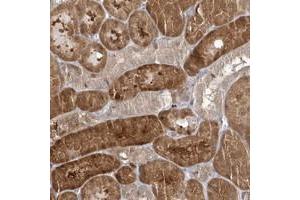 Immunohistochemical staining of human kidney with RNF7 polyclonal antibody  shows strong cytoplasmic positivity in cells in tubules at 1:20-1:50 dilution. (RNF7 抗体)