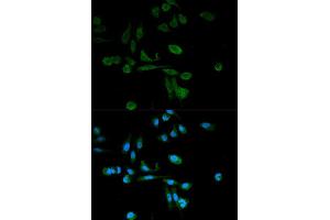 Immunofluorescence analysis of HeLa cell using SIRT7 antibody. (SIRT7 抗体  (AA 201-400))