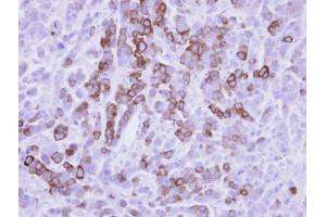IHC-P Image Immunohistochemical analysis of paraffin-embedded MDA-MB-468 xenograft, using MX1, antibody at 1:500 dilution. (MX1 抗体  (Internal Region))