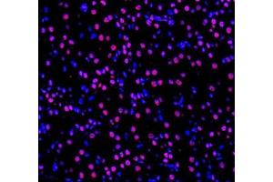 Immunofluorescence of paraffin embedded mouse kidney using GTF3C3 (ABIN7074039) at dilution of 1: 650 (400x lens) (GTF3C3 抗体)