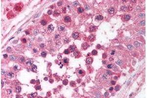 Human Testis (formalin-fixed, paraffin-embedded) stained with EGR4 antibody ABIN214101 at 5 ug/ml followed by biotinylated goat anti-rabbit IgG secondary antibody ABIN481713, alkaline phosphatase-streptavidin and chromogen. (EGR4 抗体  (C-Term))