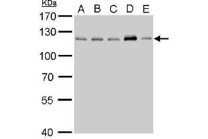 WB Image CYLD antibody detects CYLD protein by Western blot analysis. (CYLD 抗体  (C-Term))