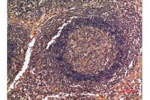 Immunohistochemistry (IHC) analysis of paraffin-embedded Human Lymph Gland, antibody was diluted at 1:100. (ALDH2 抗体  (N-Term))