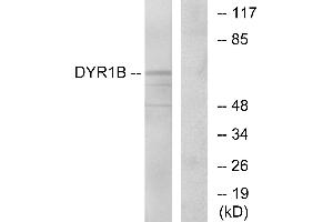 Western blot analysis of extracts from Jurkat cells, using DYR1B antibody. (DYRK1B 抗体)