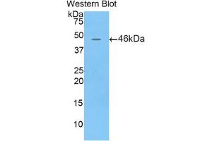 Western blot analysis of the recombinant protein. (Lipocalin 4 (LCN4) (AA 20-178) 抗体)