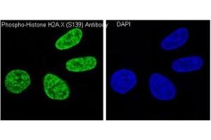 Immunofluorescence (IF) image for anti-H2A Histone Family, Member X (H2AFX) (pSer139) antibody (ABIN6654164)