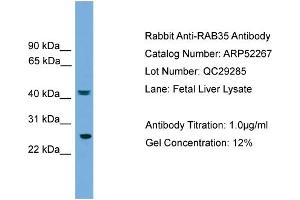 WB Suggested Anti-RAB35  Antibody Titration: 0. (RAB35 抗体  (Middle Region))