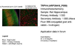 Immunohistochemistry (IHC) image for anti-Transient Receptor Potential Cation Channel, Subfamily V, Member 4 (TRPV4) (Middle Region) antibody (ABIN2776284) (TRPV4 抗体  (Middle Region))