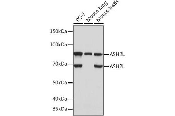 ASH2L 抗体