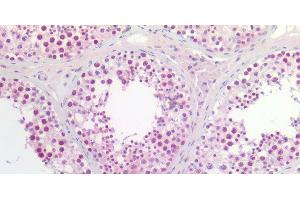 Immunohistochemistry of paraffin-embedded Human testis using CCNL2 Polyclonal Antibody at dilution of 1:200. (Cyclin L2 抗体)