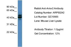 WB Suggested Anti-Antxr2  Antibody Titration: 0. (ANTXR2 抗体  (N-Term))