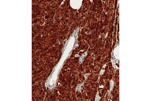 Immunohistochemistry (Paraffin-embedded Sections) (IHC (p)) image for anti-S100 Calcium Binding Protein B (S100B) antibody (ABIN651265)